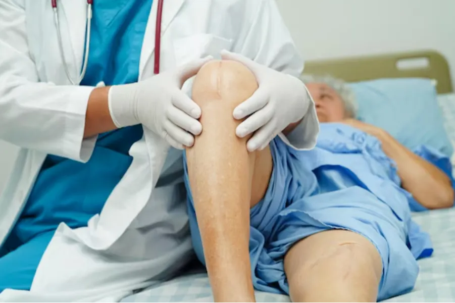 Total Knee Replacement in Nagarbhavi – A Step Toward Comfortable Movement