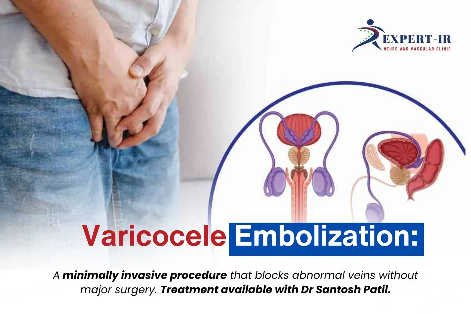 best doctor for varicocele Embolization Treatment in pune