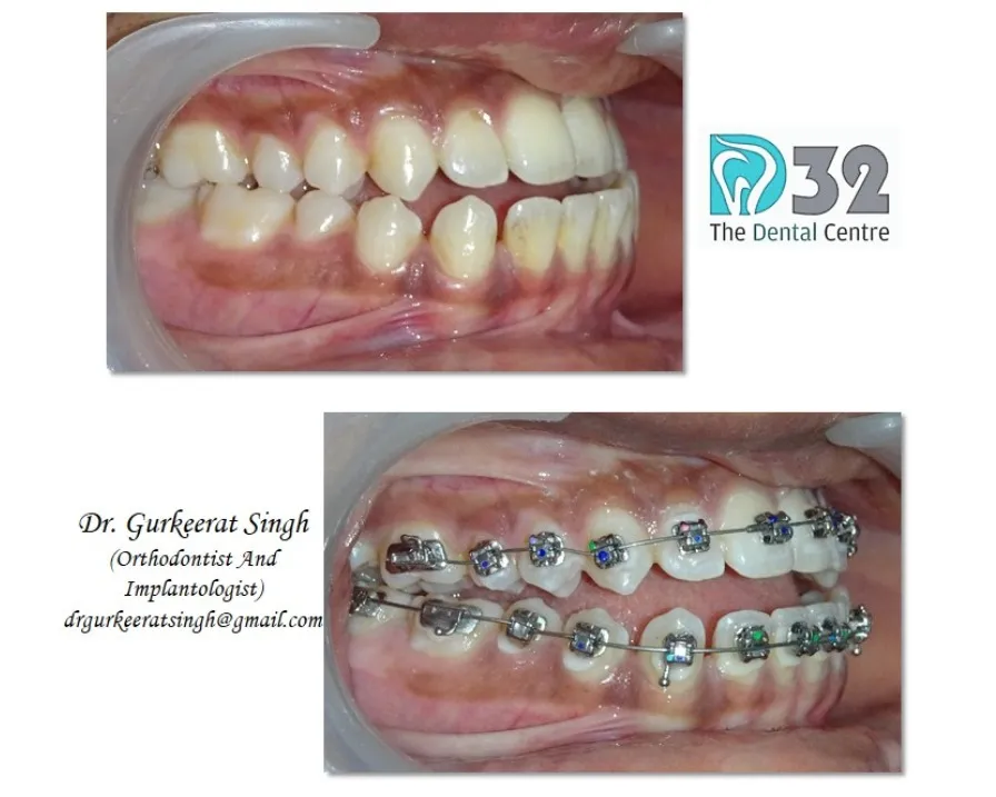 Best Orthodontist in New Delhi, India