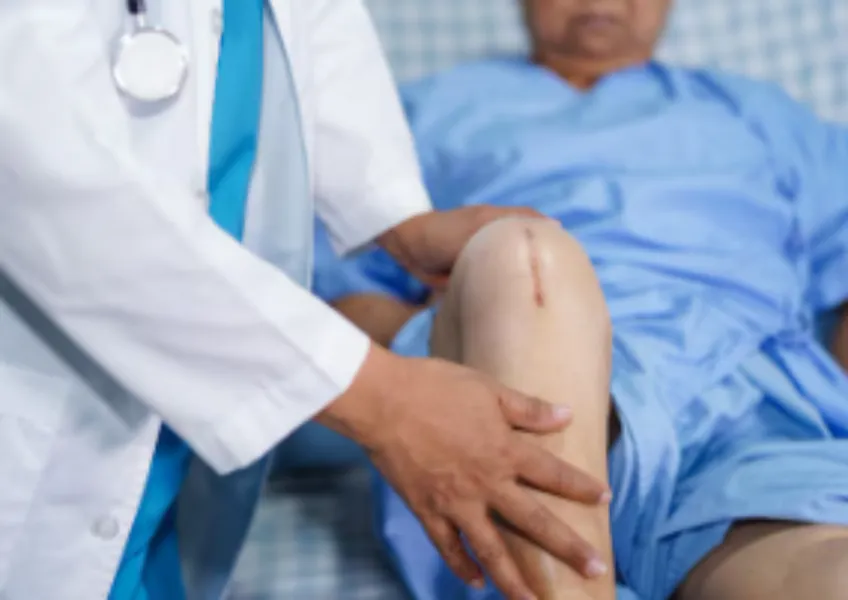 Revision Knee Replacement Surgery in Rani Bagh – Addressing Complex Joint Concerns