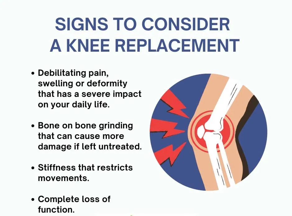 Why Do We Need Knee Replacement? Learn why knee replacement surgery becomes essential|Dr. Aman Dua