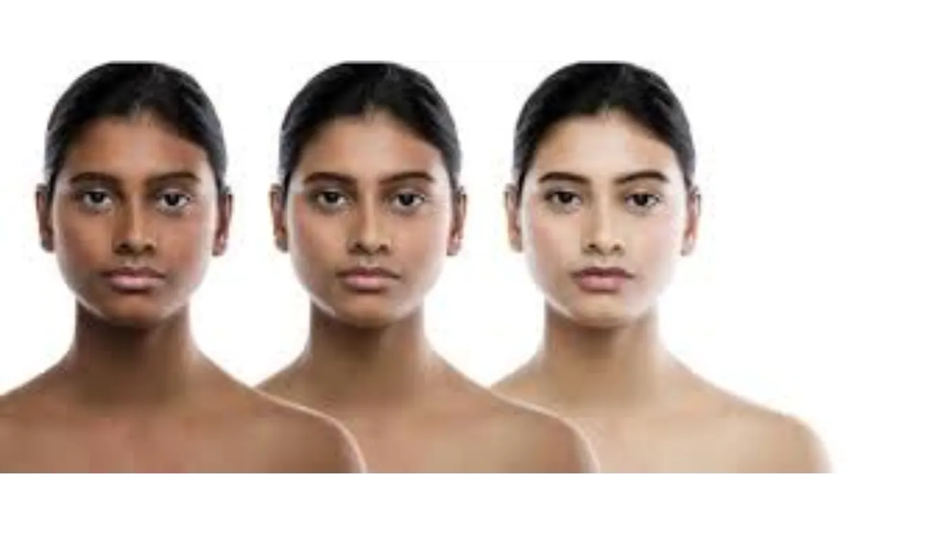 Body Whitening Treatment in Kohat Enclave - Brighten and Even Your Skin Tone