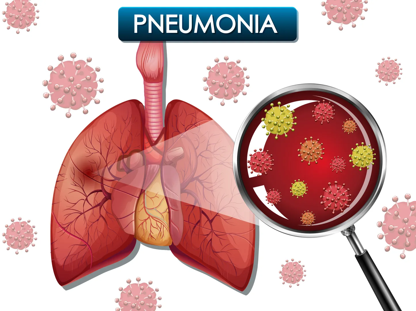 Pneumonia Treatment in Nagpur for Faster Lung Recovery