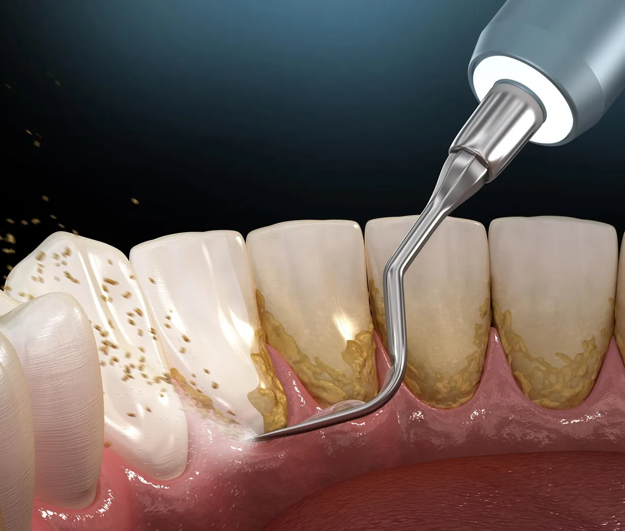 Laser dentistry is one of the most efficient and patient-friendly advancements in modern dental care