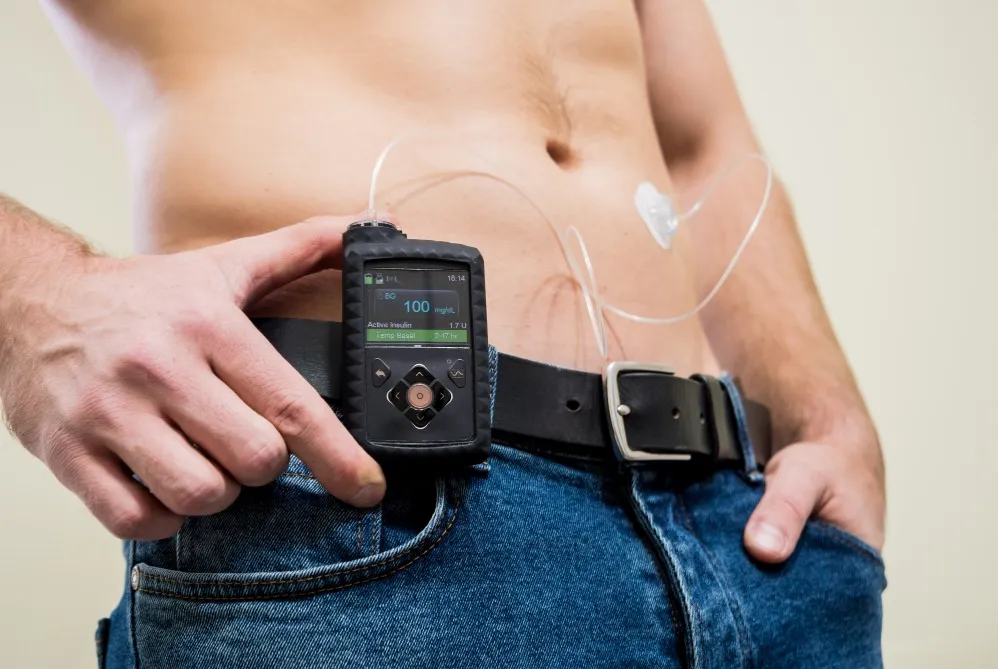 Insulin Pump Therapy in Kharghar A Smarter Way to Manage Diabetes