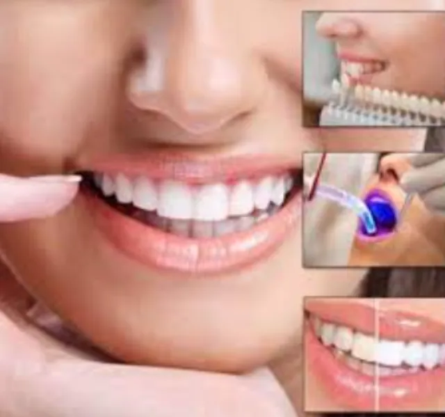 Dental Treatments in Pimpri-Chinchwad – Comprehensive Oral Care Solutions