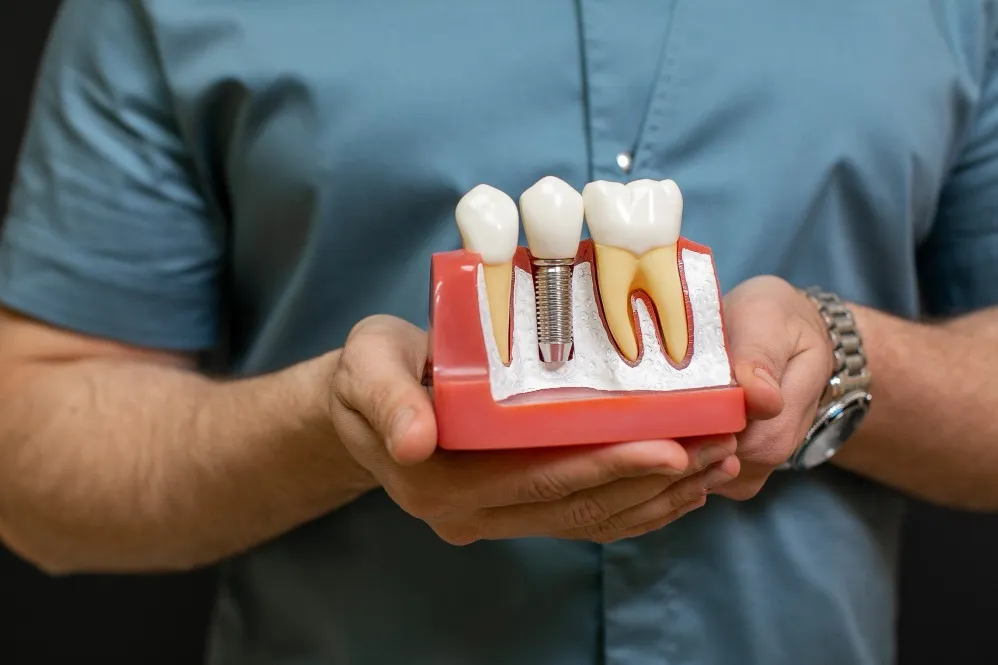 Dental Implants in Ganganagar - Replacing Missing Teeth with Stability and Confidence