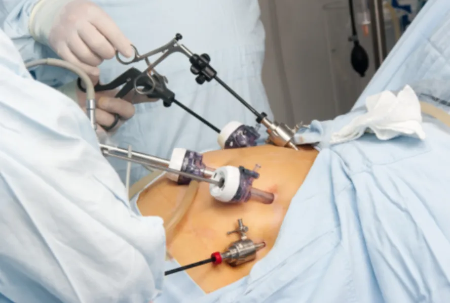 Minimally Invasive Laparoscopic Surgeon in Chembur – Modern Surgical Solutions with Faster Recovery