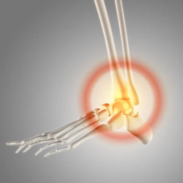 Fracture and Trauma Surgery in Noida – Timely Bone Injury Management