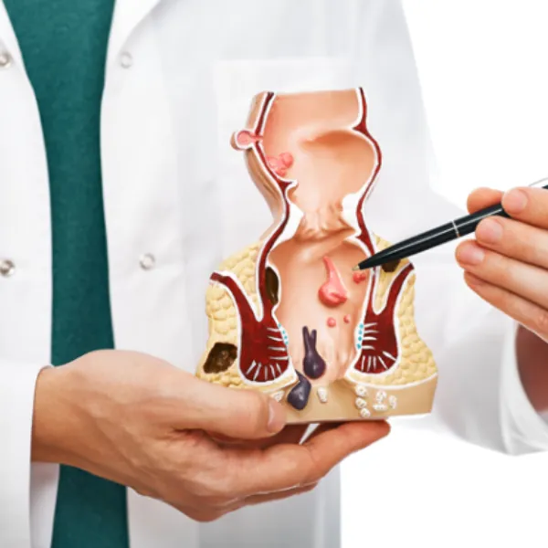 Fissure Treatment in Thane – Advanced Care for Anal Fissures and Pain Relief