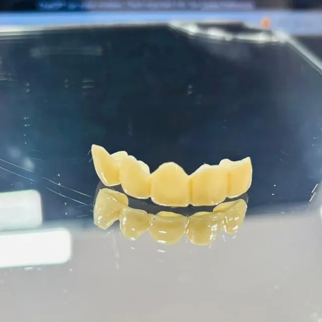 Best Dentist for Dental Crowns in Thane (Nitin Company Area): What to Expect During Treatment