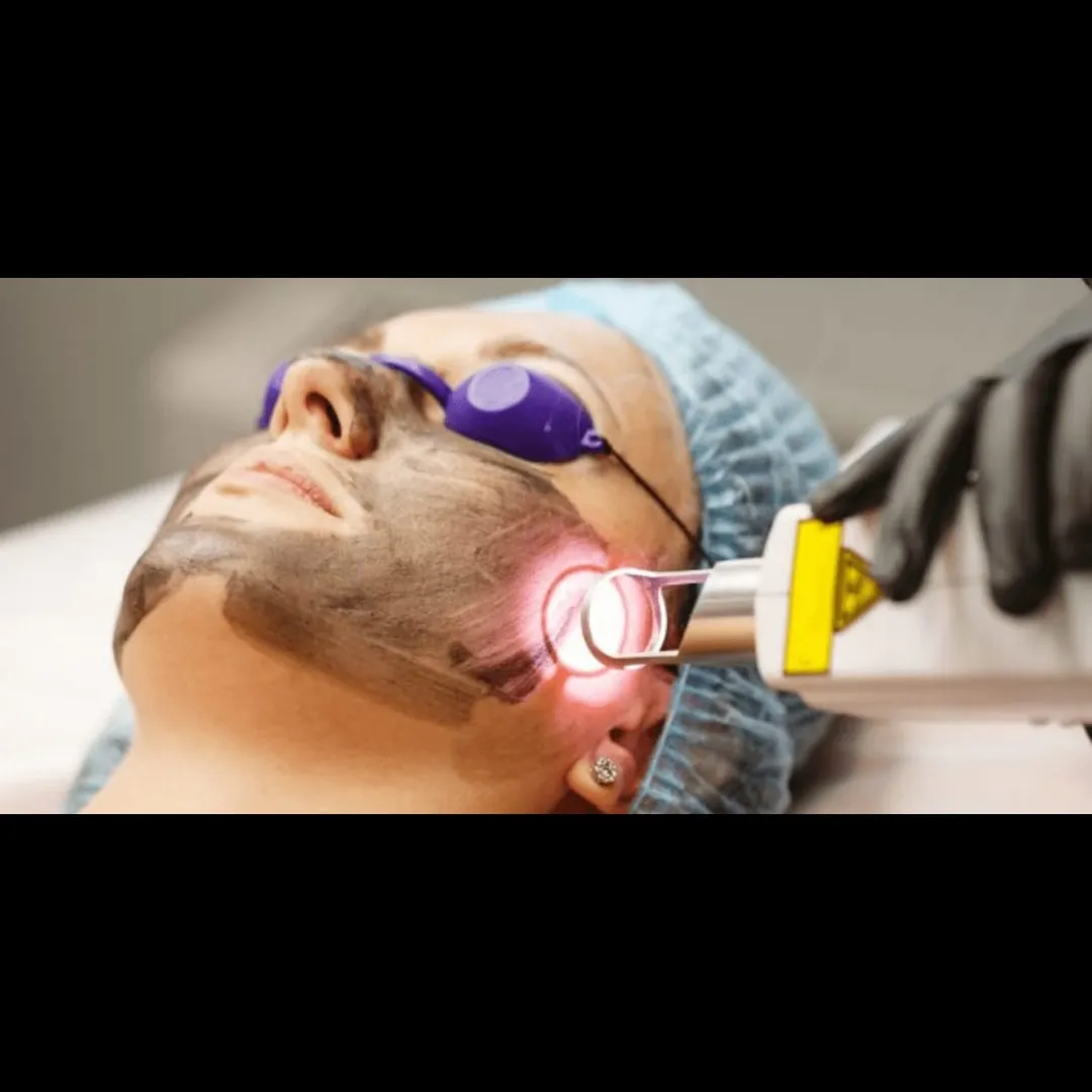 Laser facial Treatment In Vashi