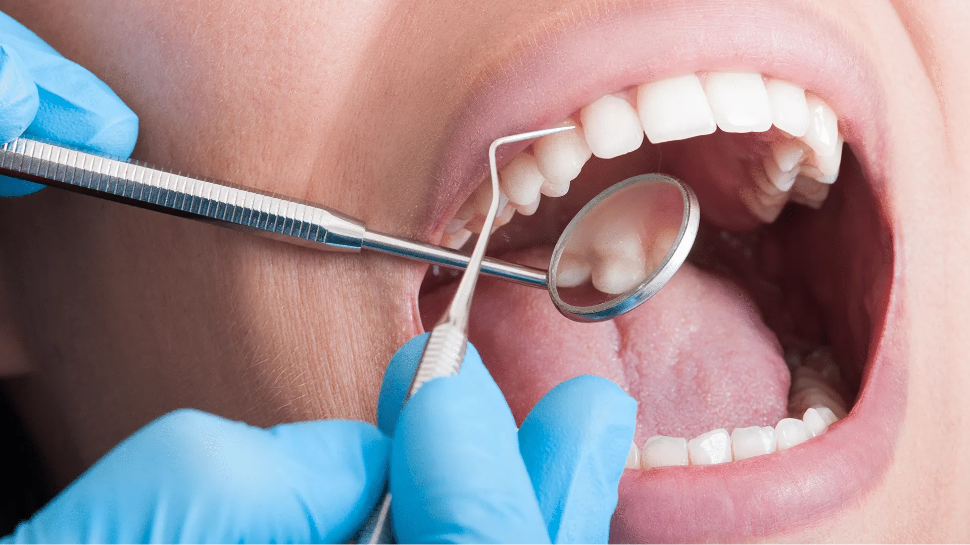 Routine Dental Check-Up in Noida Extension | P.D. Dental Clinic