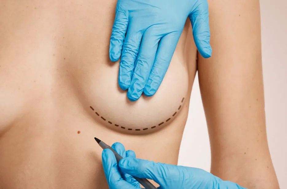 Breast Cancer Surgery in Goregaon – Care Rooted in Sensitivity and Expertise