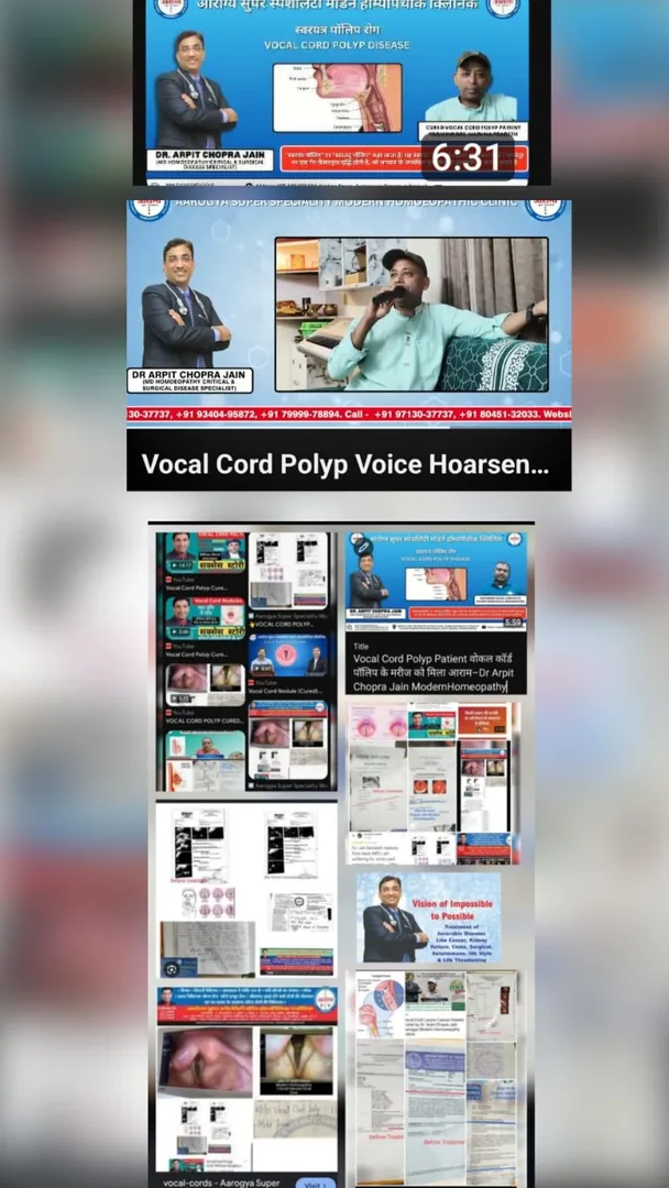 Vocal Cord Polyp Patient वोकल कॉर्ड पॉलिप के मरीज को मिला आराम–Dr Arpit Chopra Jain Aarpgya Super Sp...