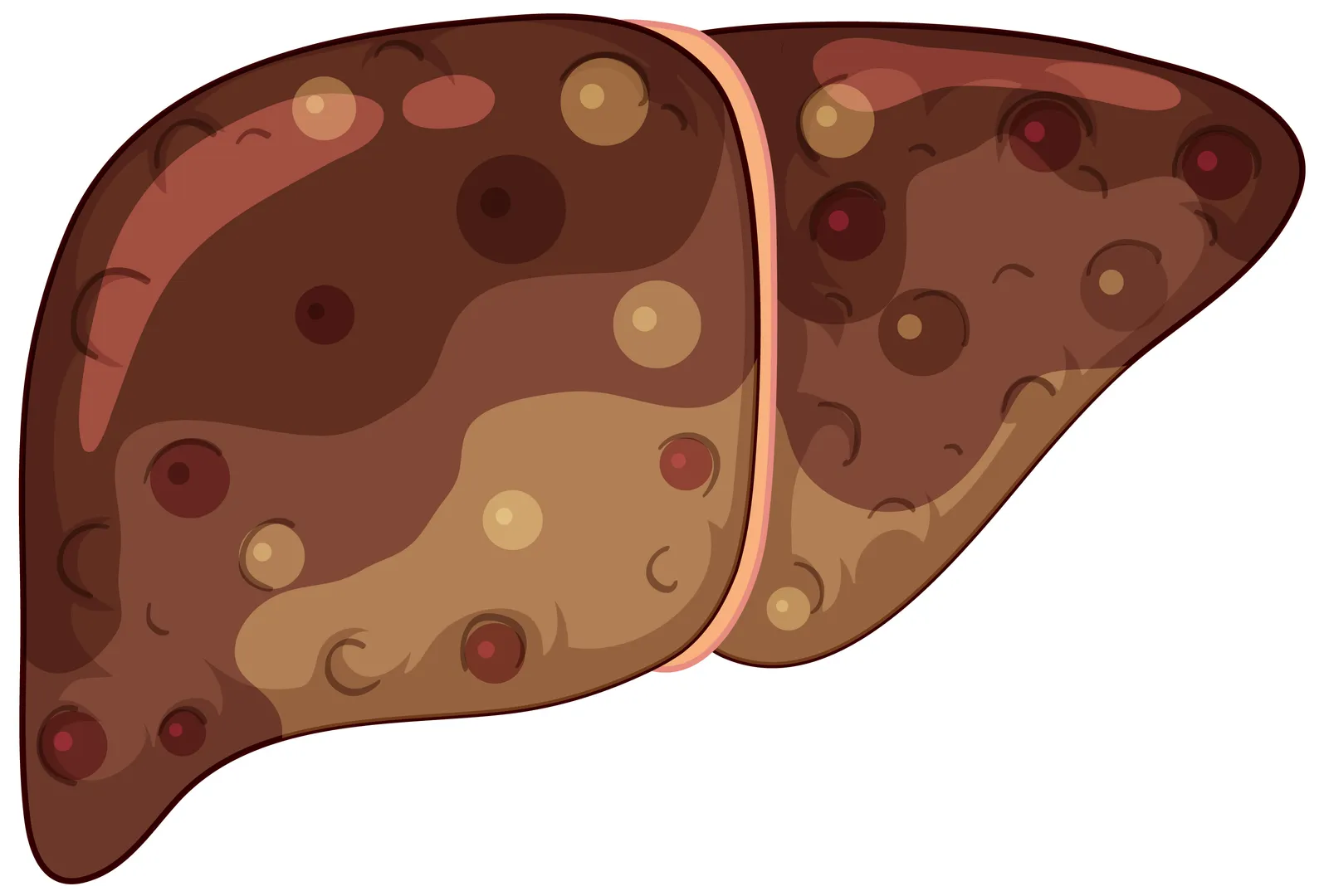 Liver Fibrosis Detection in Mumbai Why Early Screening Matters More Than You Think