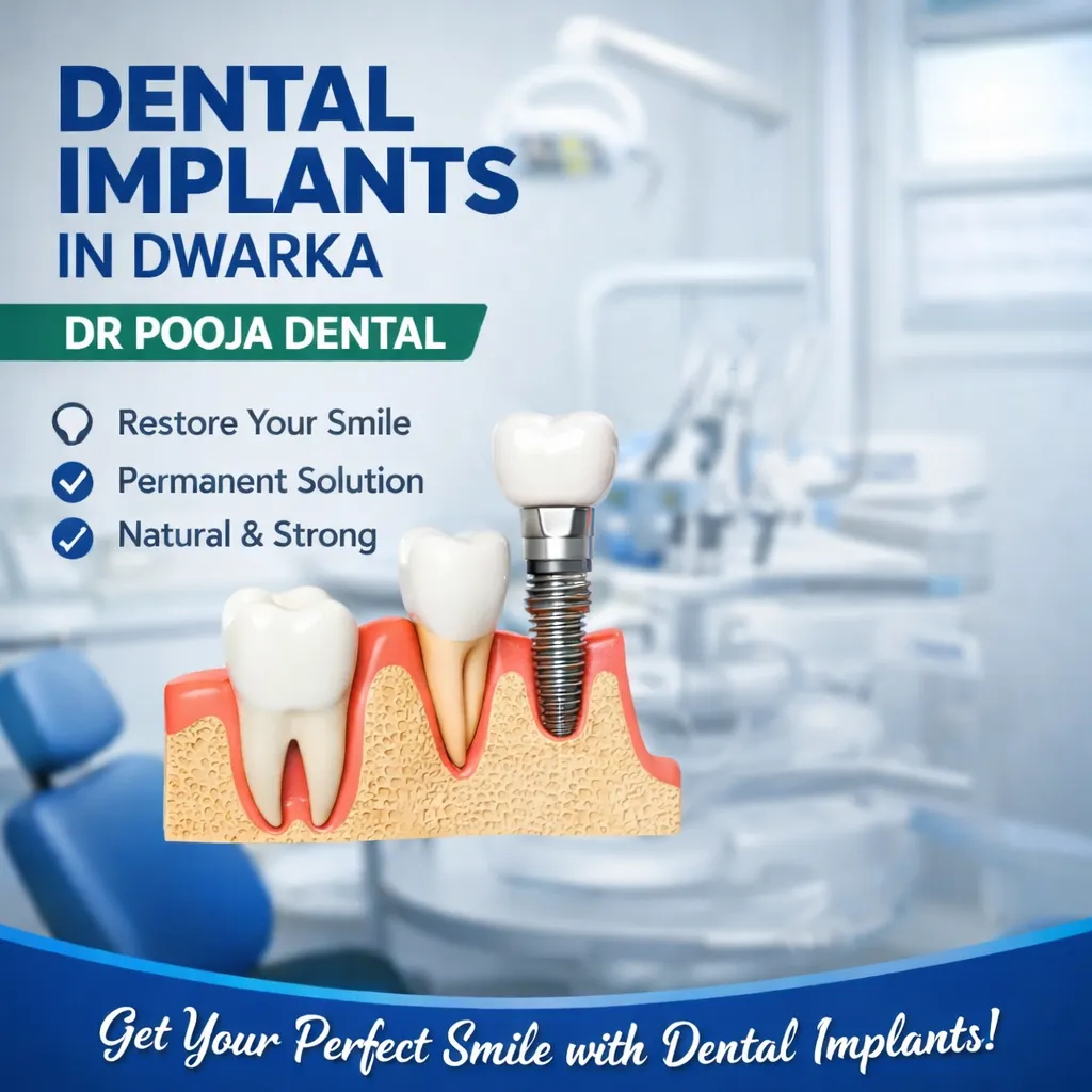 Dental Implants in Dwarka