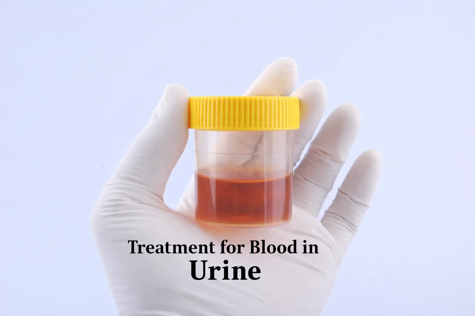 Treatment for Blood in Urine in Thane West - Understanding a Warning Sign