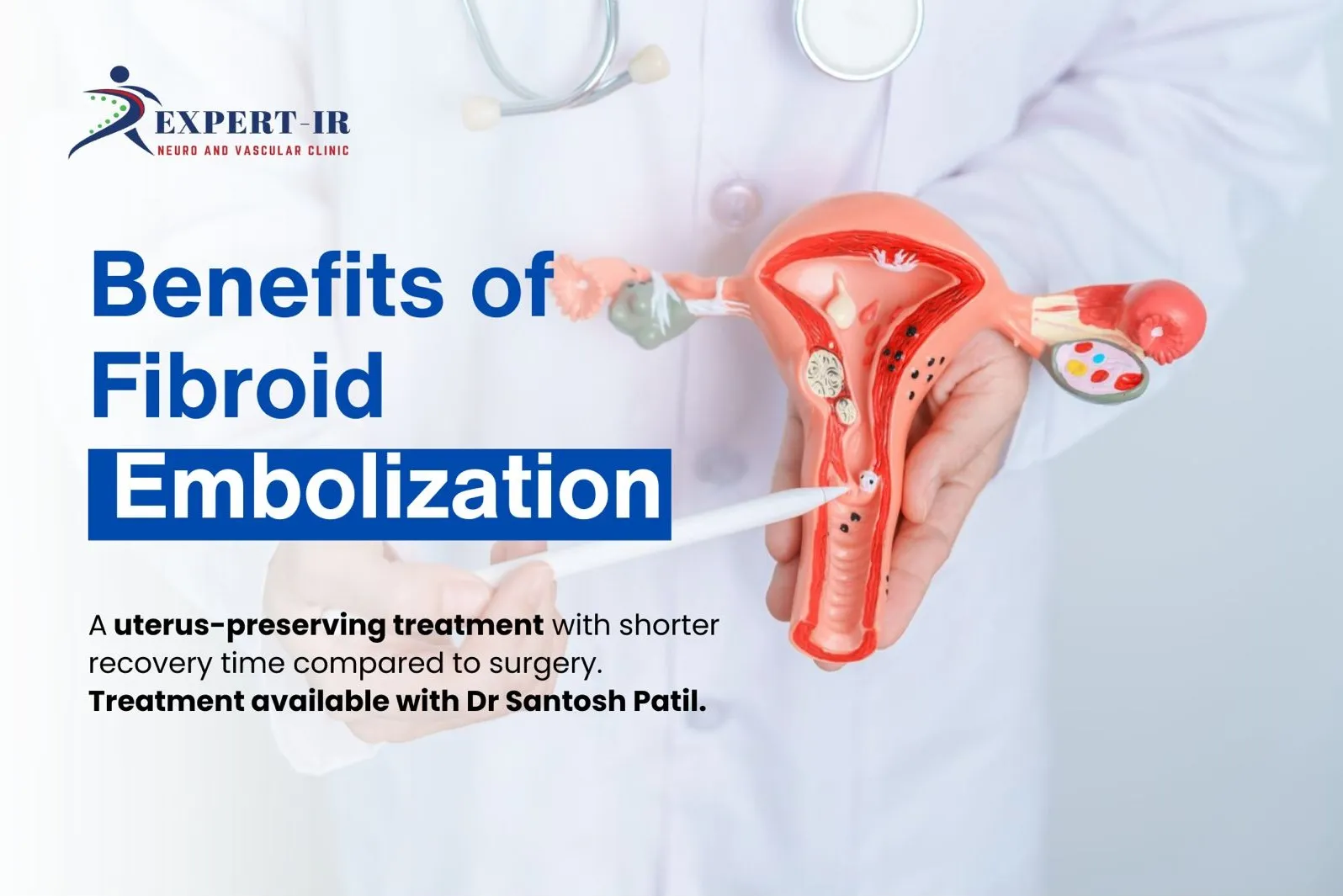 Benefits of Uterine Fibroid Embolization