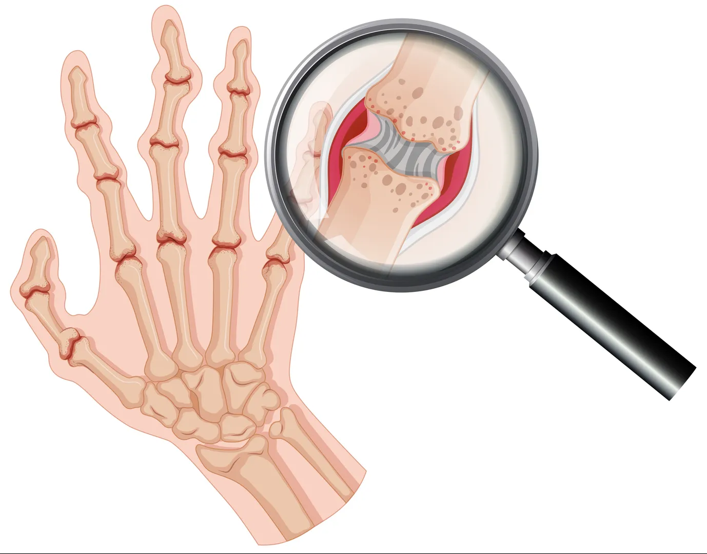 Osteoarthritis and Arthritis Care in Noida – Long-Term Joint Health Support
