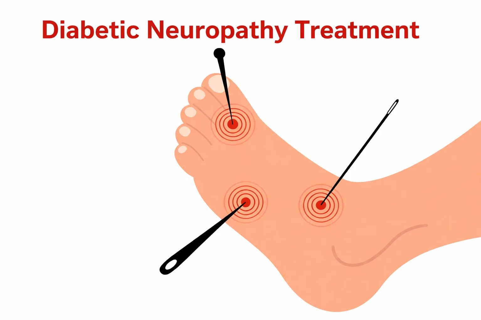 Diabetic Neuropathy Treatment in Kalamboli Understanding Nerve Health in Diabetes
