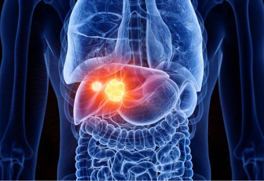 Liver Cancer Surgeon in Nashik – Focused Treatment with Thoughtful Care