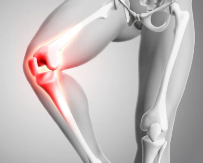 Advanced Knee Replacement Surgery in Pune – Restoring Mobility for Severe Knee Arthritis
