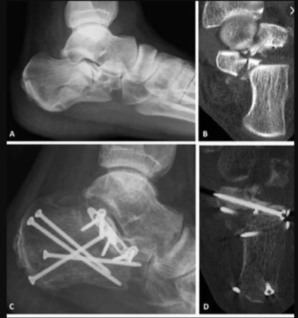 Sports Injury Orthopedic Doctor in Nagpur Effective Care for Active Lifestyles