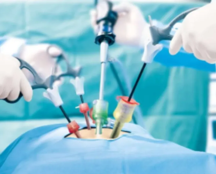 Laparoscopic Digestive Surgery in Thane – Advanced Minimally Invasive Care for Digestive Disorders