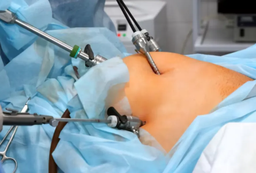 Minimally Invasive Laparoscopic Surgery in Grant Road – Modern Surgical Care with Faster Recovery