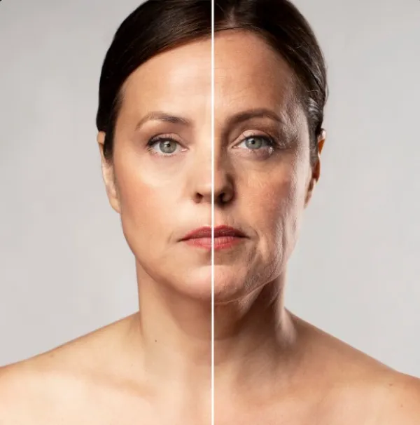 IPL Anti Aging Facial in Rohini – A Modern Approach to Youthful Skin