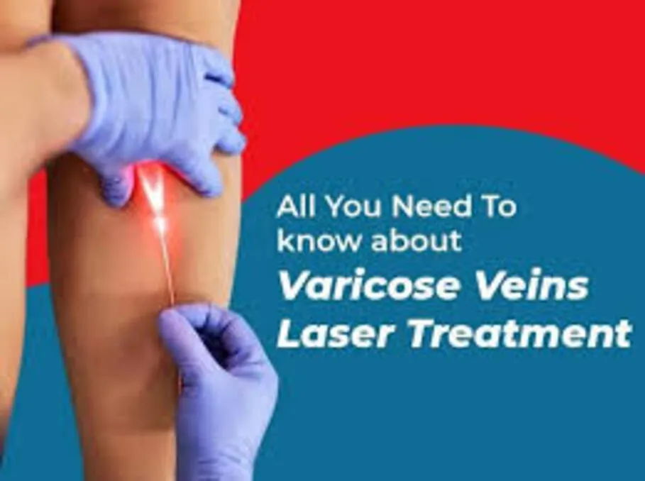 Varicose Vein Treatment in Goregaon – Restoring Comfort and Circulation