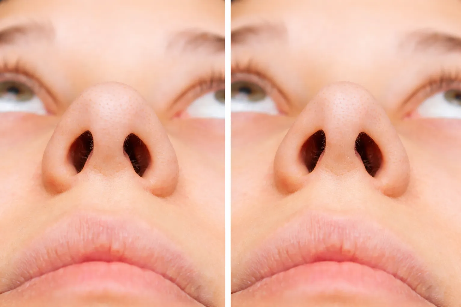 Nose Job Specialist in Pune Understanding Functional and Aesthetic Needs