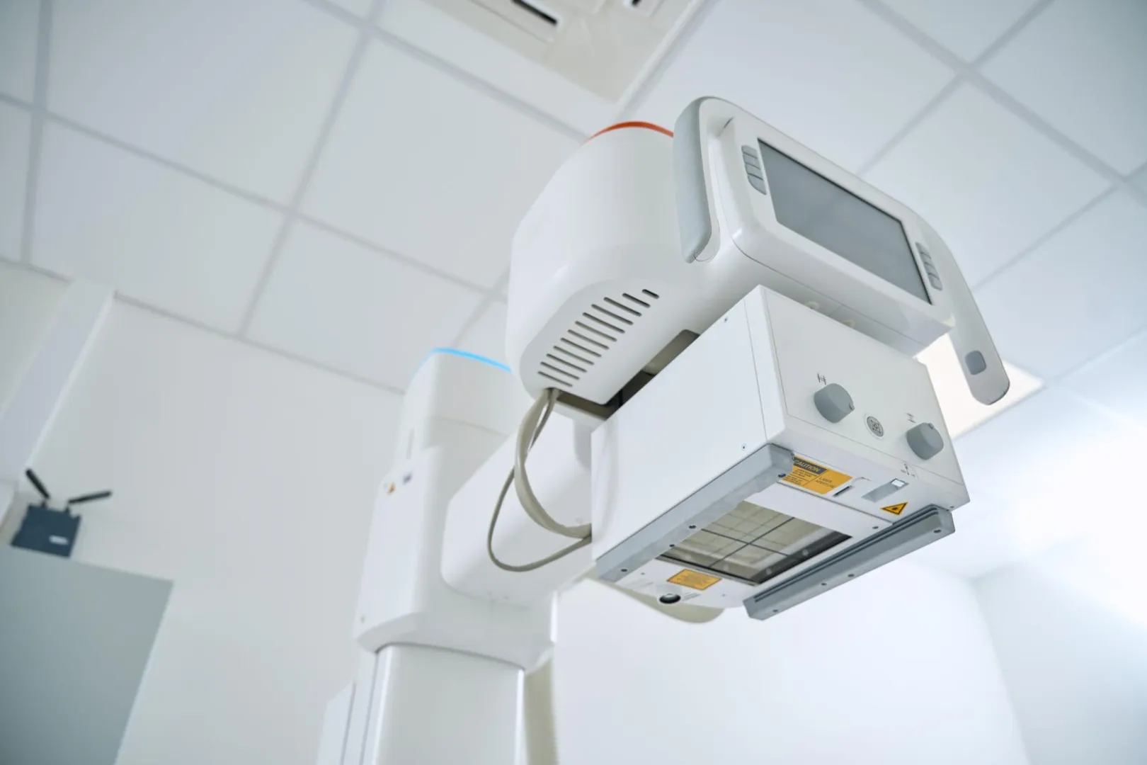 Digital X-Ray Services in Pune