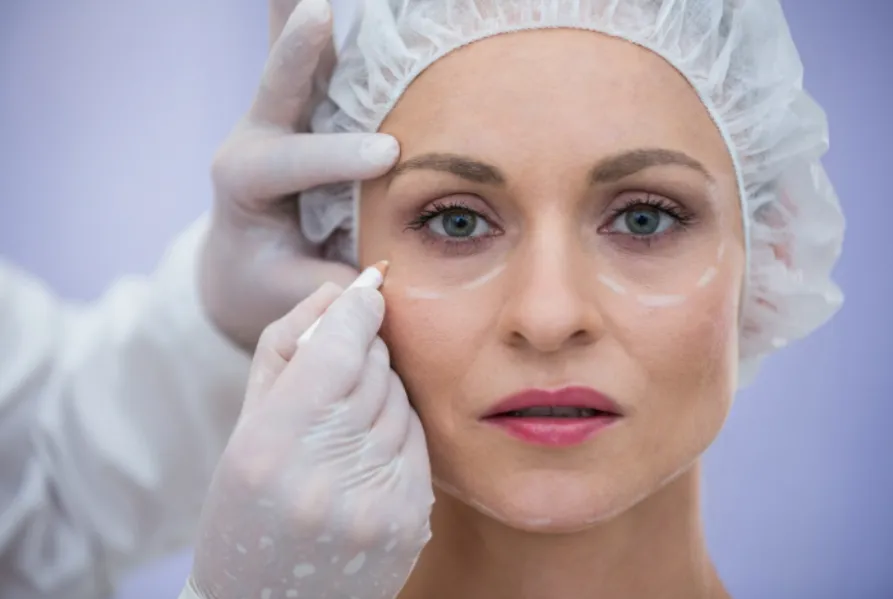 Oculoplasty and Eyelid Surgery Treatment in Marine Lines – Restoring Eye Function and Appearance