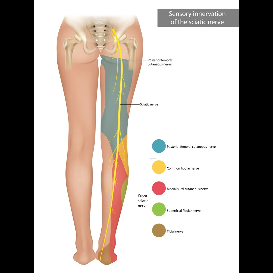 Slip Disc vs. Sciatica: What is the Difference?
