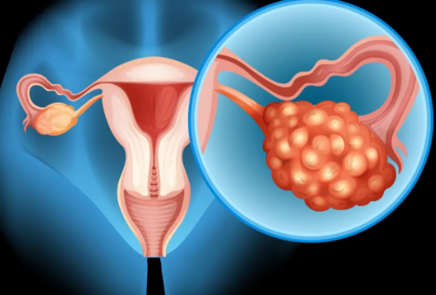 Endometriosis pain management specialist in Worli When Period Pain Is More Than Just Pain