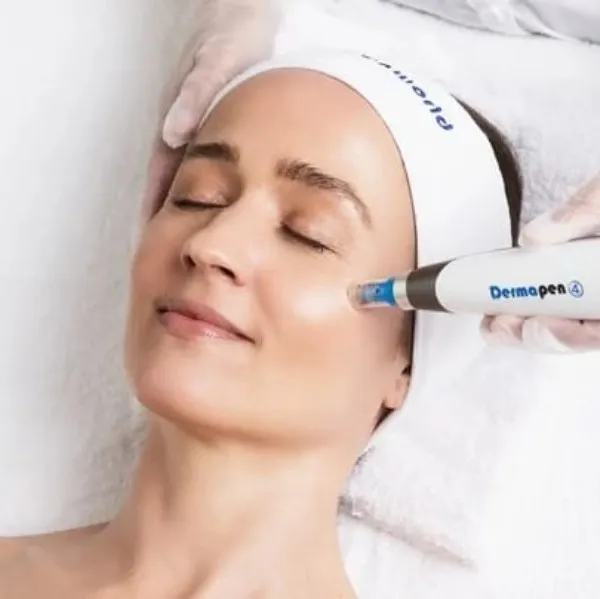 Dermapen Treatment In Vashi
