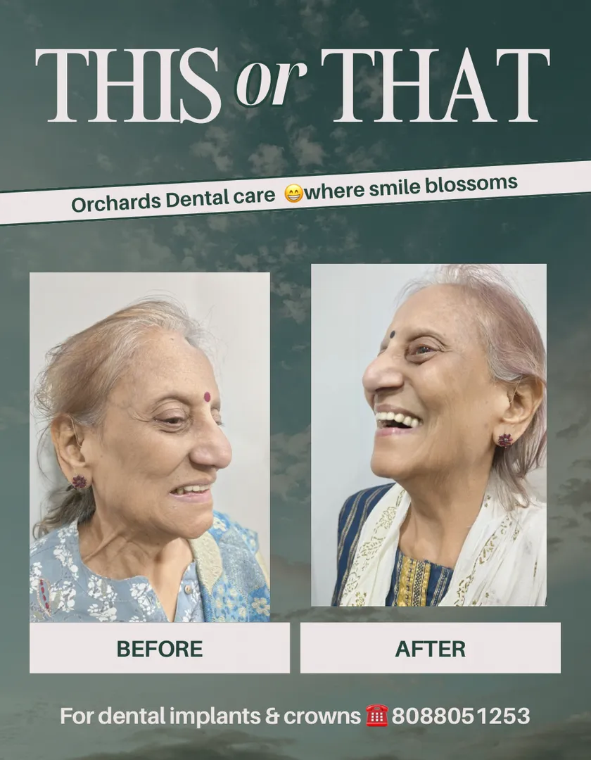 Orchards Smile Stories with dental implants ✨