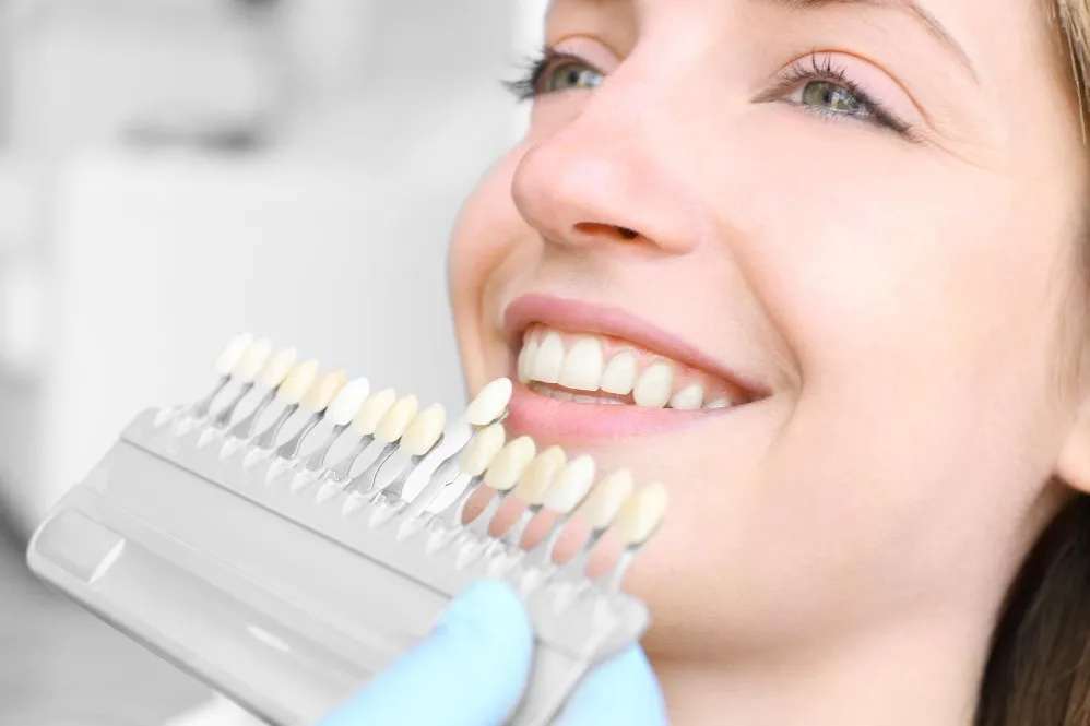 Dental Veneers in Sarjapur Road for a More Balanced and Confident Smile