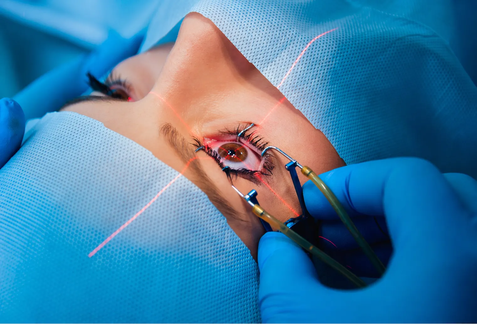 Best Phaco Surgery in Chandigarh for Treating Cataract Without Long Recovery