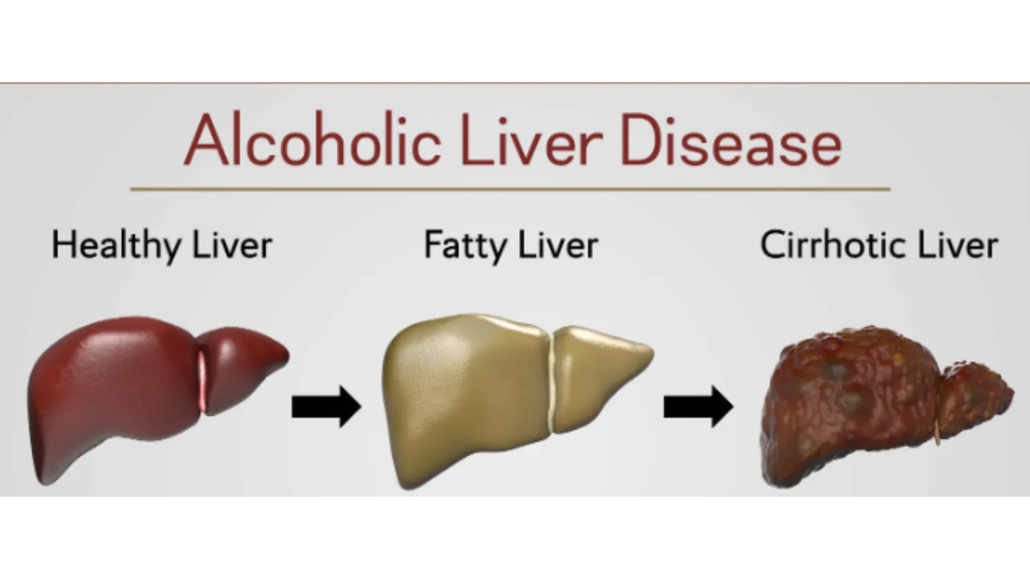 Alcoholic liver Diseases Management in Pune – Regaining Control Through Timely Care