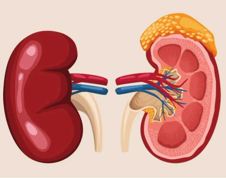 Laparoscopic Nephrectomy Surgery in Kemps Corner Minimally Invasive Kidney Removal Procedure