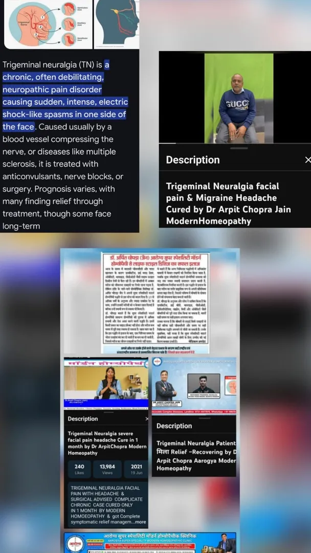 Trigeminal Neuralgia Patient को मिला Relief –Recovery by Dr Arpit Chopra Aarogya Super Speciality M...