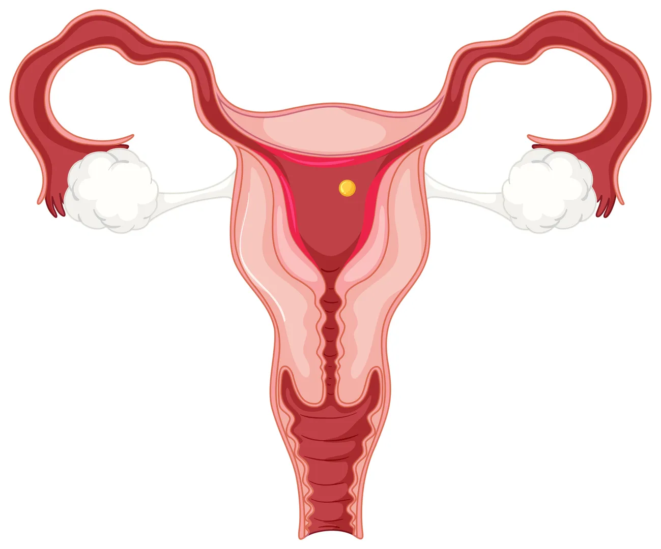 Cervical cancer screening and prevention in Sewree The Importance of Early Checks