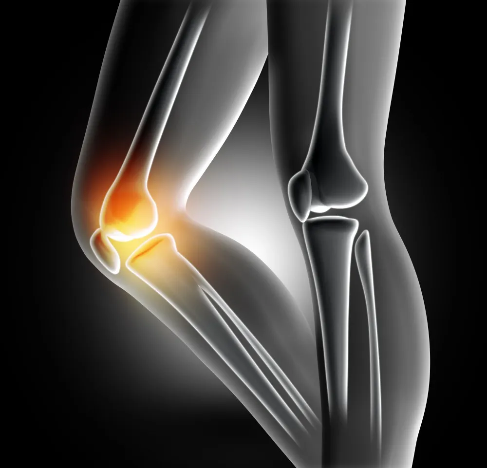 Knee Replacement Surgeon in Pune When Knee Pain Starts Affecting Daily Life