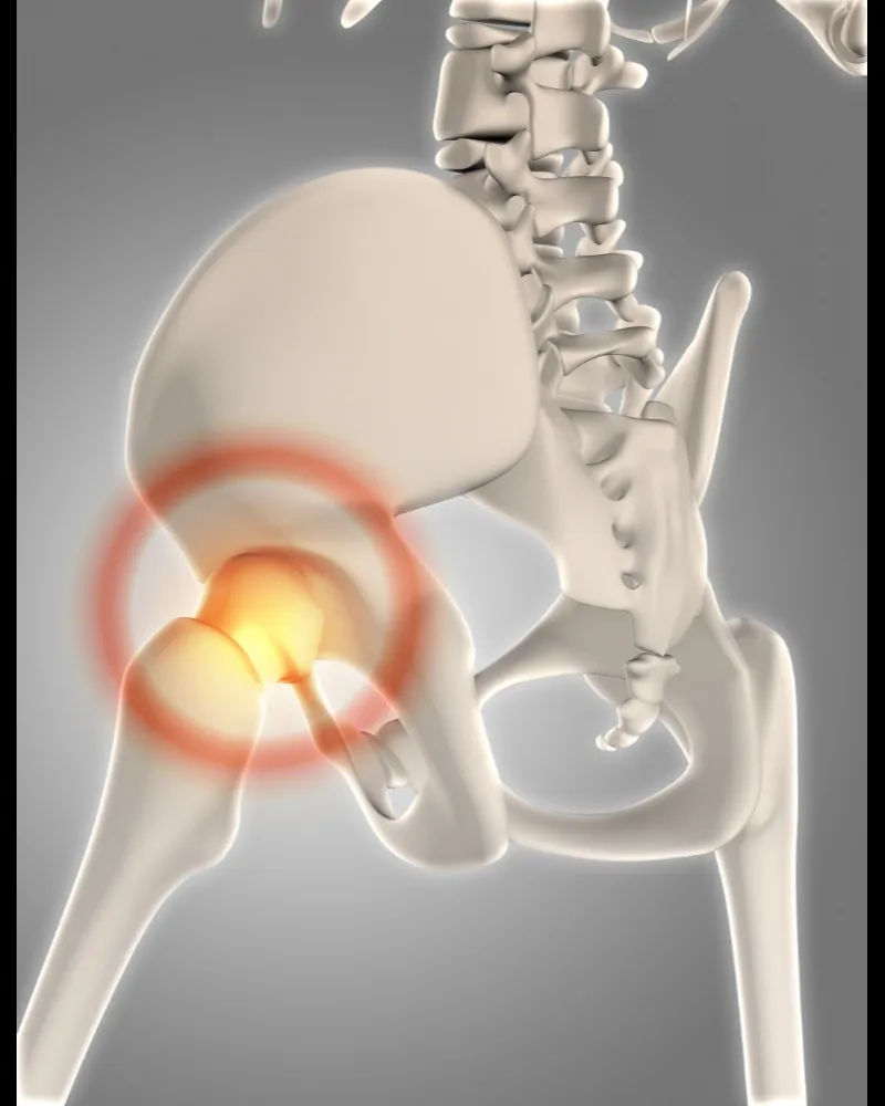 Hip Fracture Treatment in Rohini Sector 15