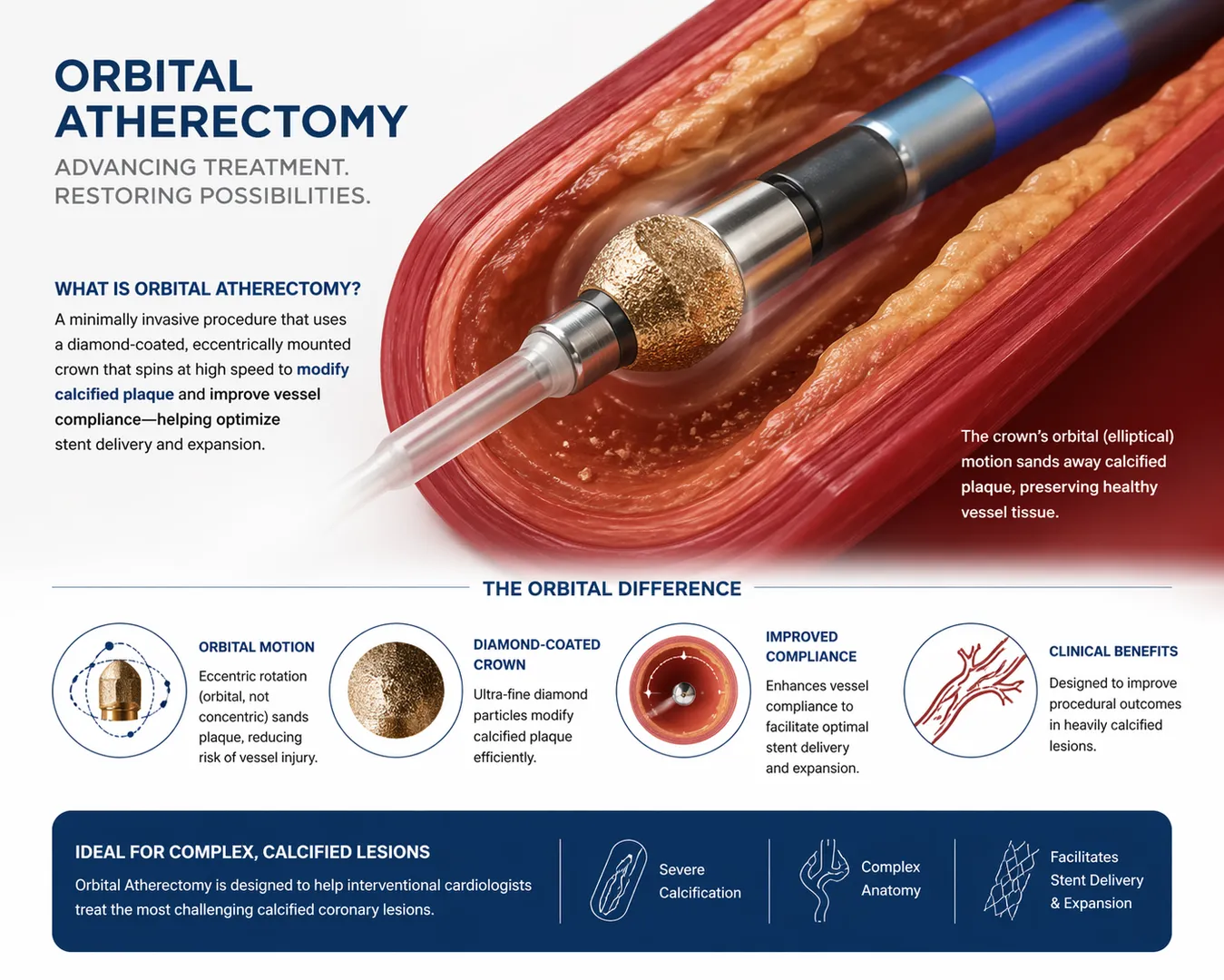 Orbital Atherectomy in Koparkhairane for Better Artery Preparation