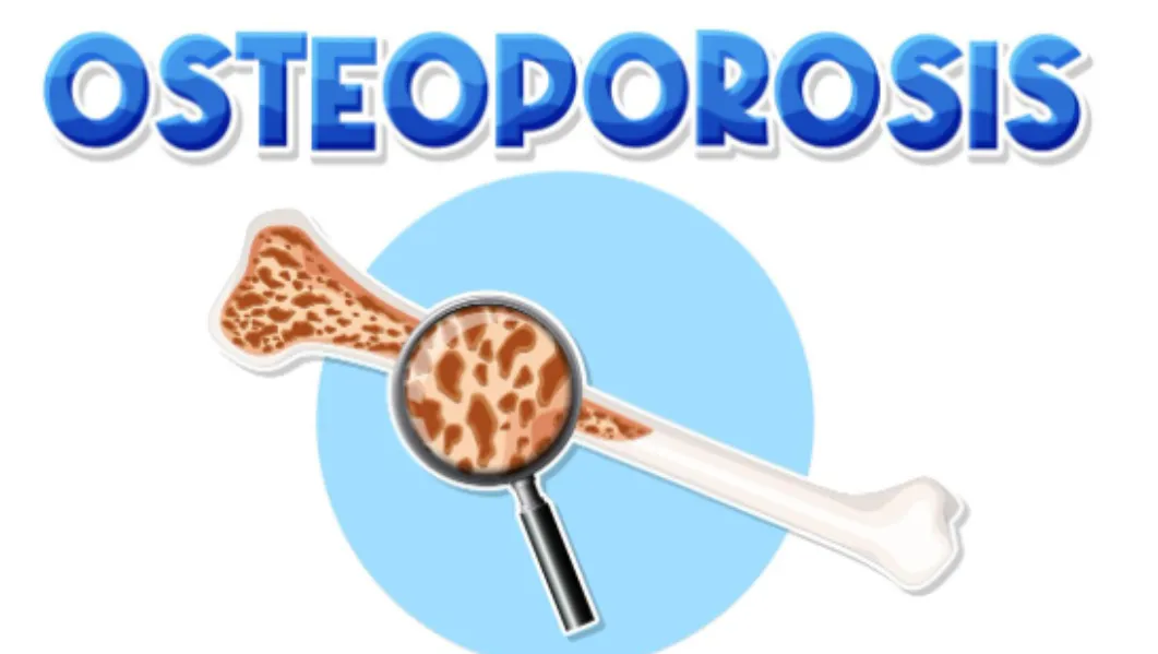 Osteoporosis Diagnosis and Treatment in Noida Protecting Bone Health Early