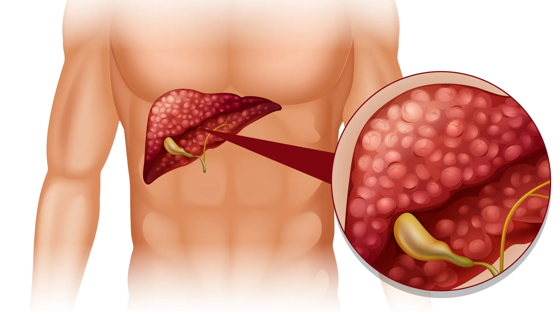 Early Liver Disease Detection in Mumbai Why Screening Matters Before Symptoms Grow